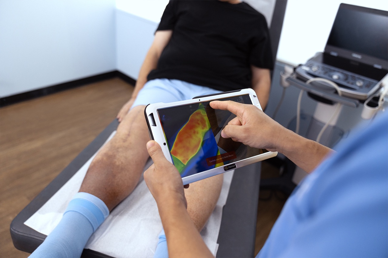 Discover the future of vein treatments and healthcare advancements. Explore cutting-edge technologies like HIFU, robotic-assisted procedures, nanotechnology, and AI-driven personalized care. Learn how genetic insights and improved minimally invasive techniques are revolutionizing vein care for faster recovery, less discomfort, and targeted prevention strategies. Stay informed about innovations shaping a new era in vascular health.