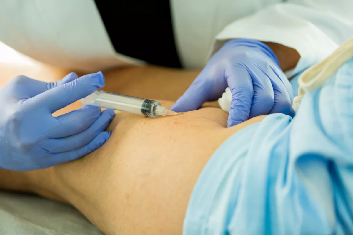 &iquest;Es la escleroterapia adecuada para tus venas? Descubre 4 cosas esenciales: duraci&oacute;n, efectos secundarios, recuperaci&oacute;n y resultados reales. &iexcl;Inf&oacute;rmate en Metro Vein Centers!